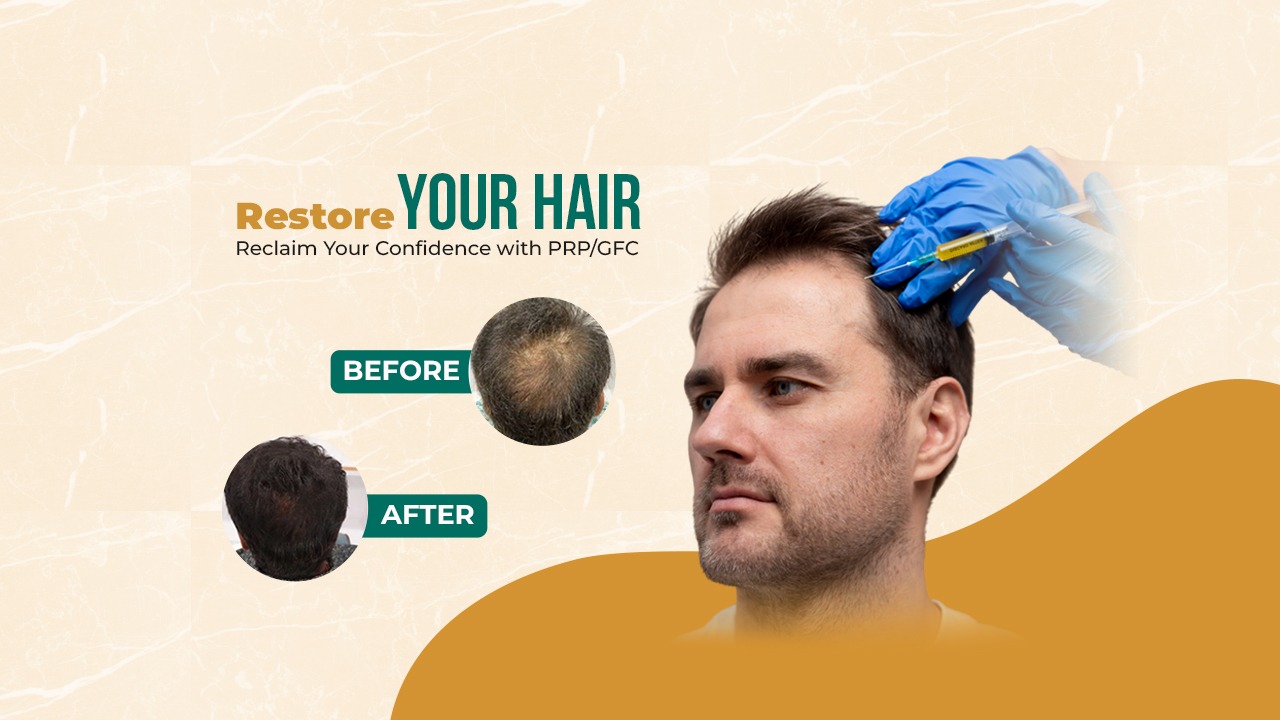 What You Should Know About Microneedling for Thinning Hair