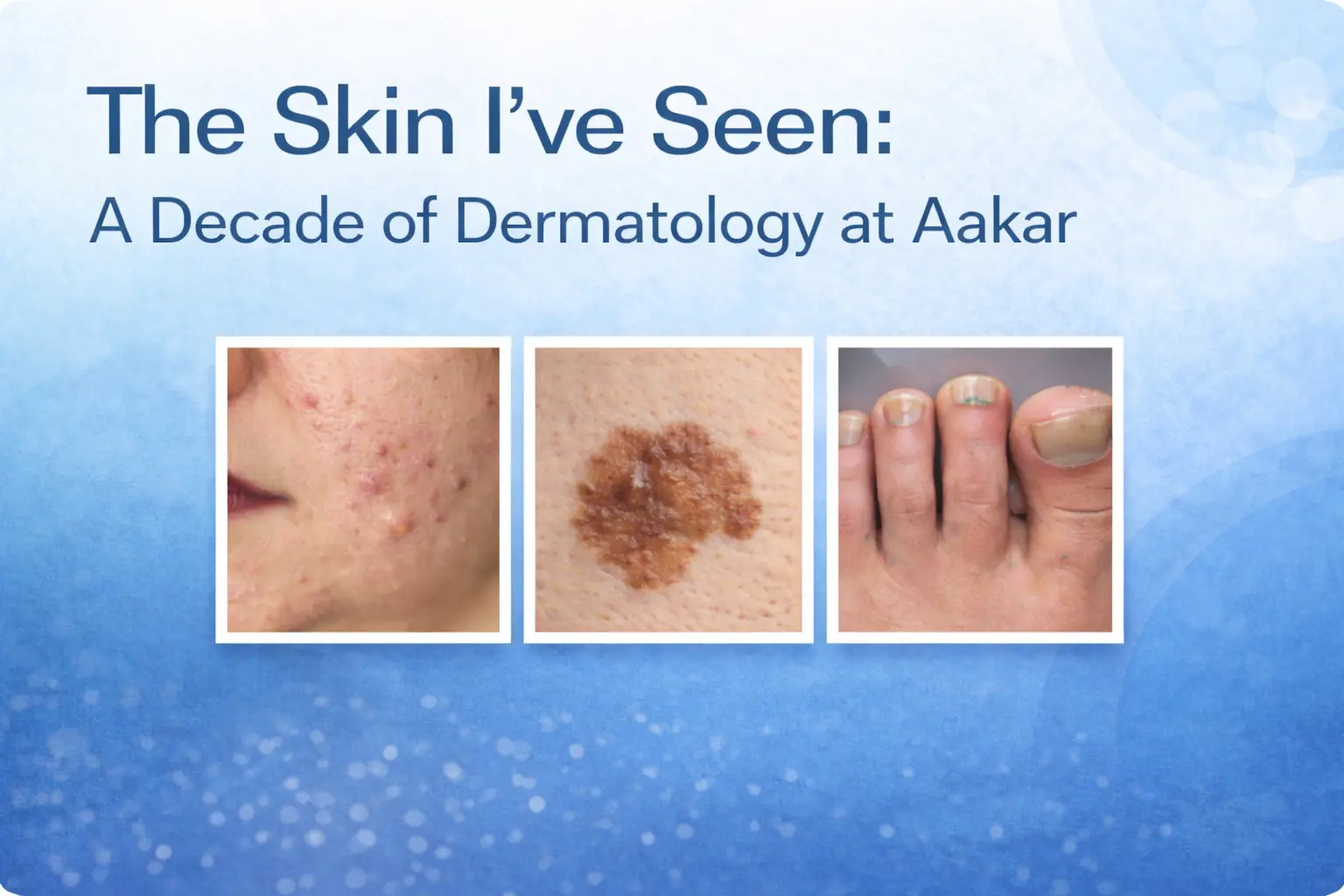 Discover a decade of dermatology experience at Aakar Nepal. Expert treatment for acne, hair loss, skin conditions, STIs. Professional skin care insights.