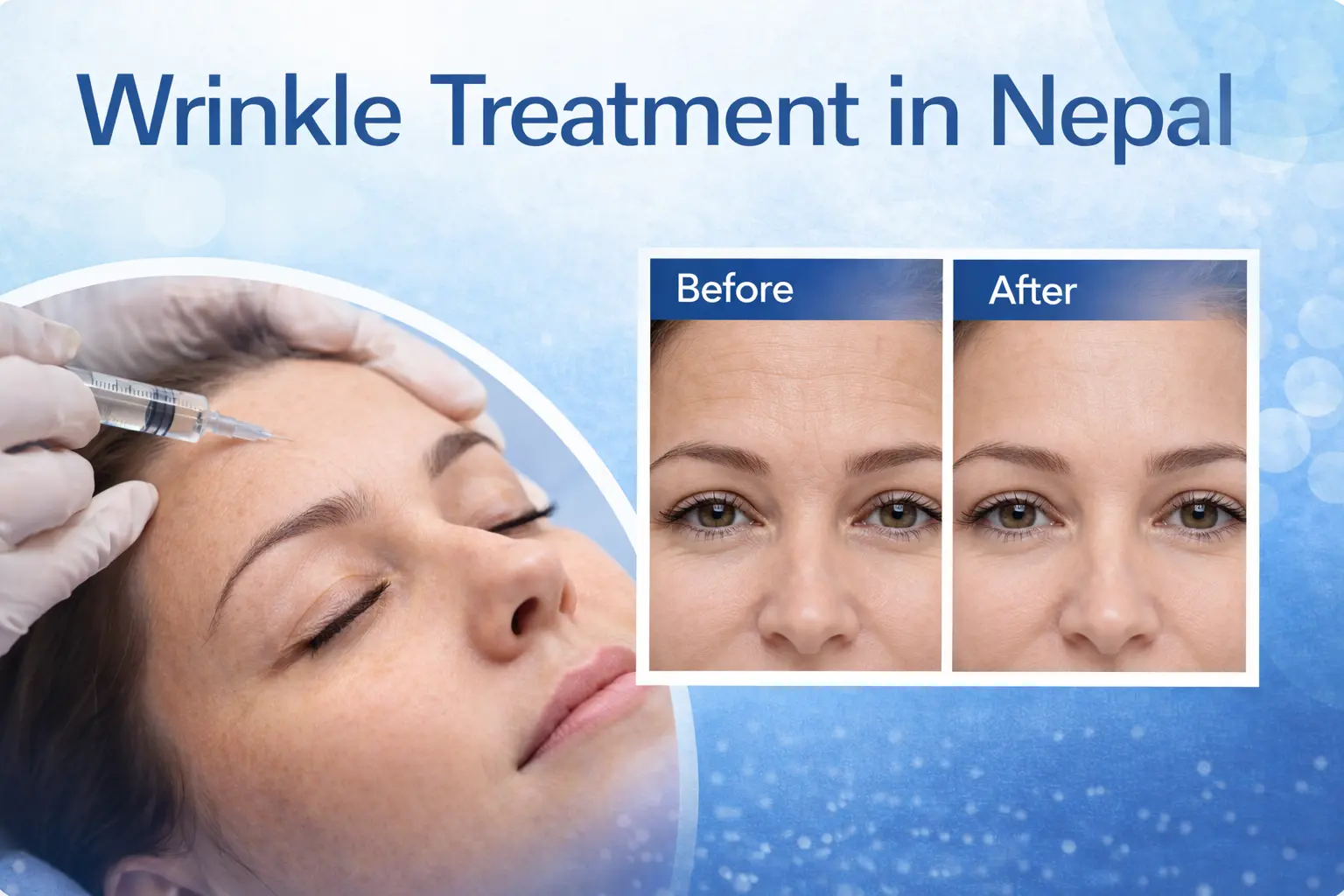 Wrinkle treatment in Nepal. Botox, fillers, laser, HIFU & manymore. Fresh skin, renewed confidence. Safe, effective anti-aging solutions.