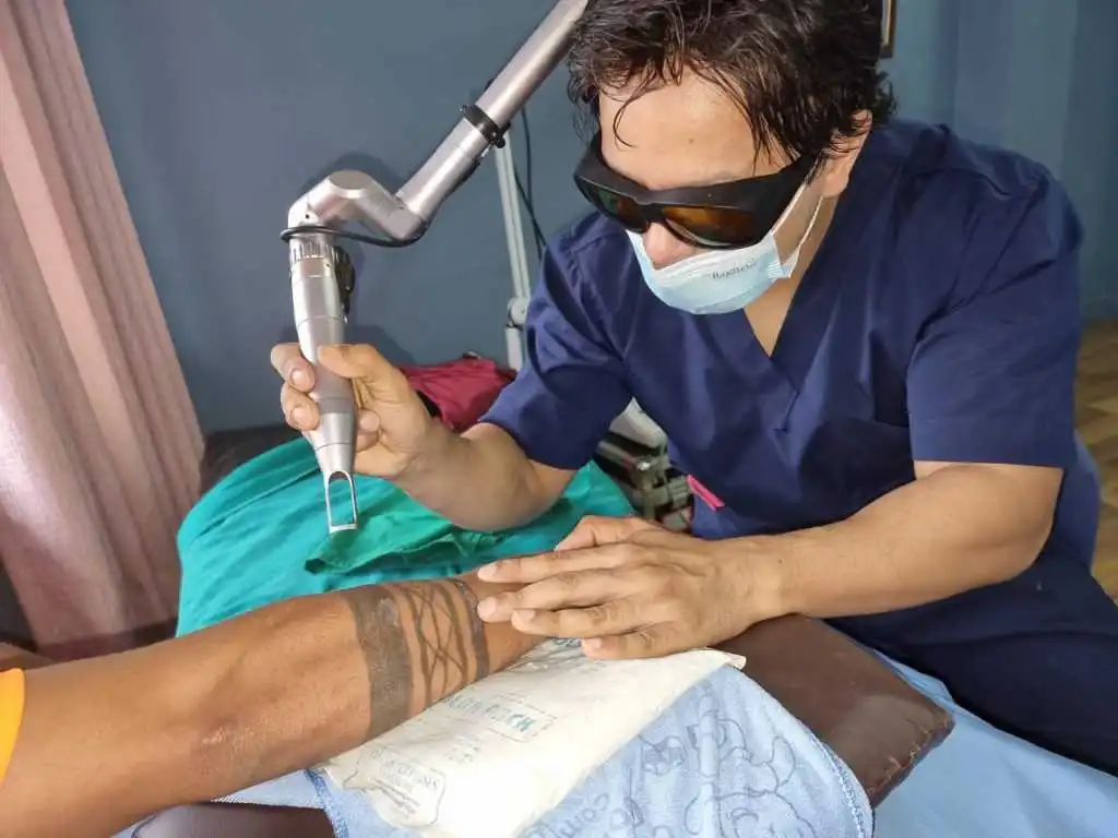 A safe and effective laser treatment designed to remove unwanted tattoos with precision. Gradual fading, minimal downtime, and expert care for clear, healthy skin.