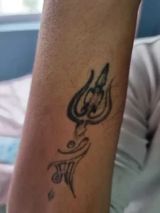 Sample 5 showing laser tattoo removal treatment results along with the approximate cost of removal ranging between Rs. 5,000 to Rs. 6,000, depending on the size and condition of the tattoo.